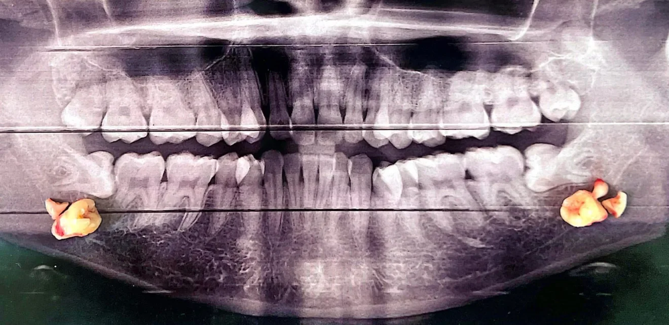 Psalm23 Dental Care oral surgery services — photo 5